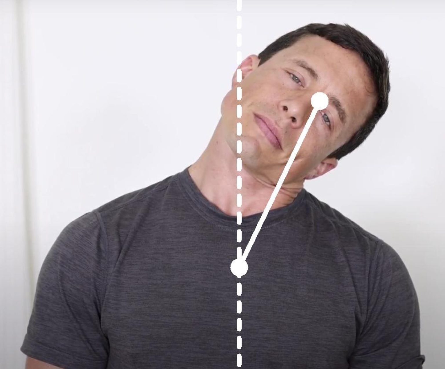 What is the Normal Range of Motion of the Neck? - NeckCheckUp